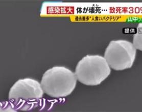 日本食人菌感染今年已致超250人死亡 防控警报升级